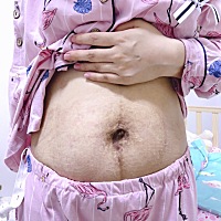 摘了收腹带 鼓起勇气看了看 生孩子的代价 这几天真的不敢看自己的肚子 腰粗的太多
