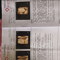 双胞胎， 可以看出性别吗？哈哈 怀双胎肚子太大真的难受！