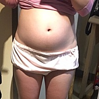 17周肚子特别大，有和我一样的孕妈吗？ a