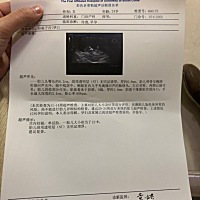 12周第一次产检，NT一次过，宝宝很配合，妈妈爱你❤️