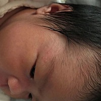 宝宝脸上这是什么，这两天长的