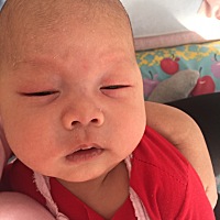 昨天打完卡介苗和乙肝疫苗，回来就发现眼皮有点儿小红疙瘩，然后今儿早晨就肿了，这个是湿疹吗，群里有...