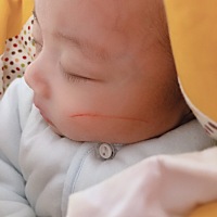 请问大家，宝宝脸抓破了会留疤吗？指甲也经常剪，这已经是第二次抓的这么深了，可以涂什么东西吗？看着...