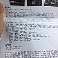 宝宝很健康😄，做的四维，有没有会看男女的大神呢？还是比较好奇宝宝性别❤️