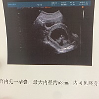 我们这里的B超怎么都不写得具体一点。像什么完全看不懂。