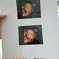 今天做4维顺利通过，宝宝脐带绕颈一周，医生说没关系，愿每个宝妈4维都顺利通过，宝宝都足月出生，爸妈...