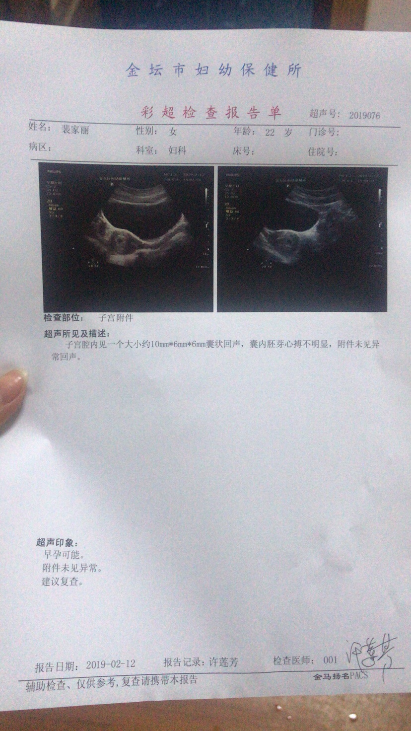 这个算是一切正常吧