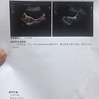 这个算是一切正常吧