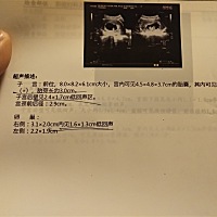 是乔治还是佩琪呢😊我可爱的宝宝