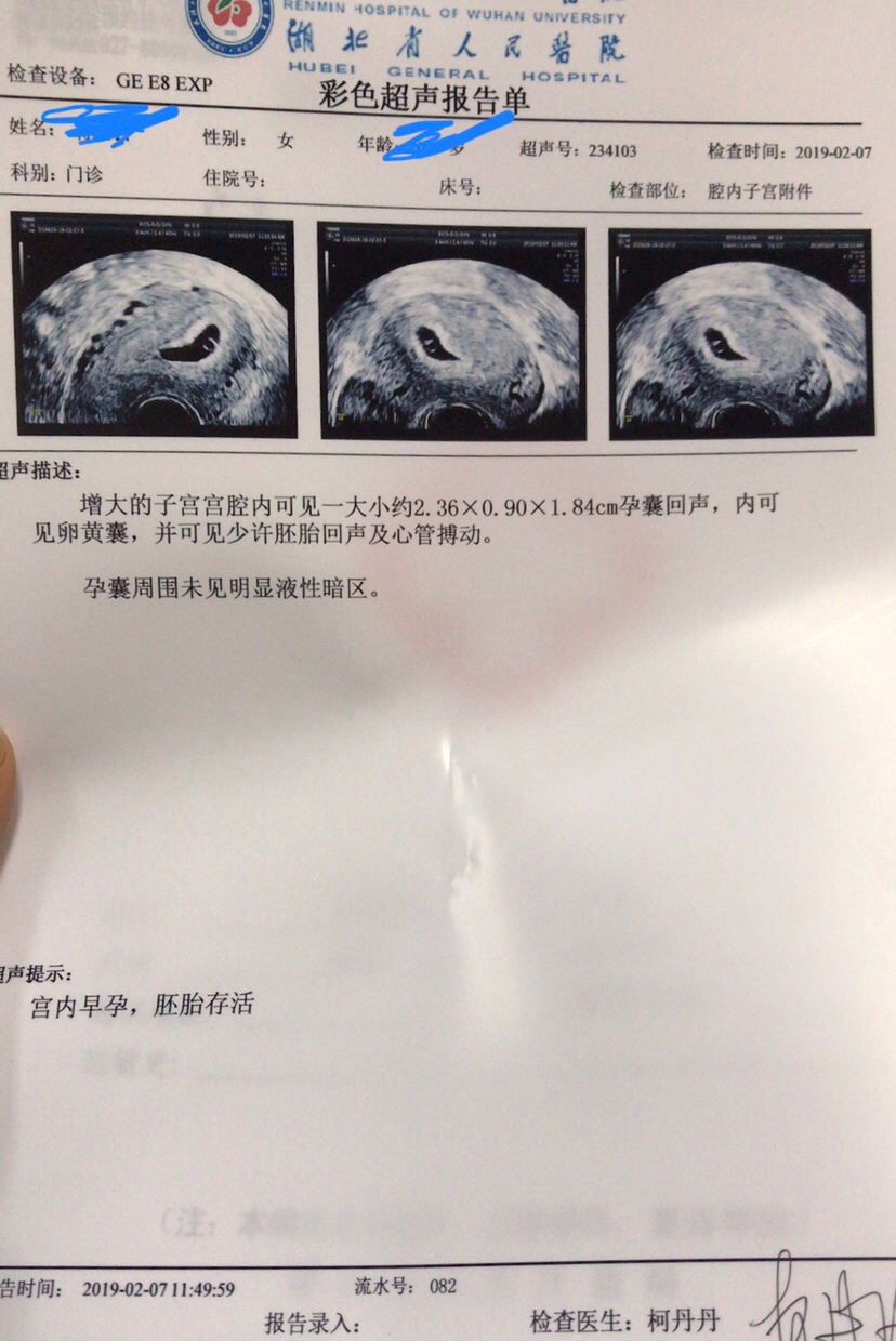 有没有有经验的宝妈帮忙看看的🤪我觉得是男孩哎，不过男孩女孩我都喜欢，只是想知道一下性别，不知道我看的准不准