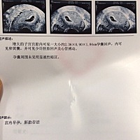 有没有有经验的宝妈帮忙看看的🤪我觉得是男孩哎，不过男孩女孩我都喜欢，只是想知道一下性别，不知道...