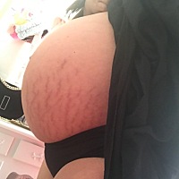 男宝接健康男宝，肚型这样生男宝，怀孕期间孩子心率