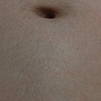 这肚子长毛是什么情况？肚子还会痒痒