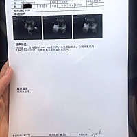 本人怀孕也够奇葩的.末次月经12月21号，今年1月3号未避孕.十号流感发烧39.6度.使用了抗生素.还打了屁股...