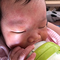 请问各位宝妈 这是湿疹吗 身上也有 急急急