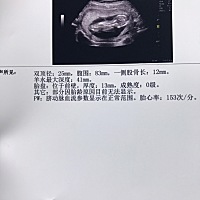 很好奇，请有经验的宝妈来看看男女