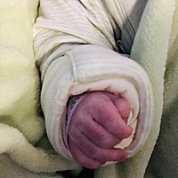 2.12（正月初八），猪宝宝，3kg，本来打算先顺，绕颈2周，剖出，一切顺利，辛苦了老婆，路漫漫，相信我...