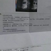 三胎意外怀孕双胞胎，去照b超居然还是双胞胎，不知道生不生，家里没有矿啊，预产期是10月10号，有没有同...