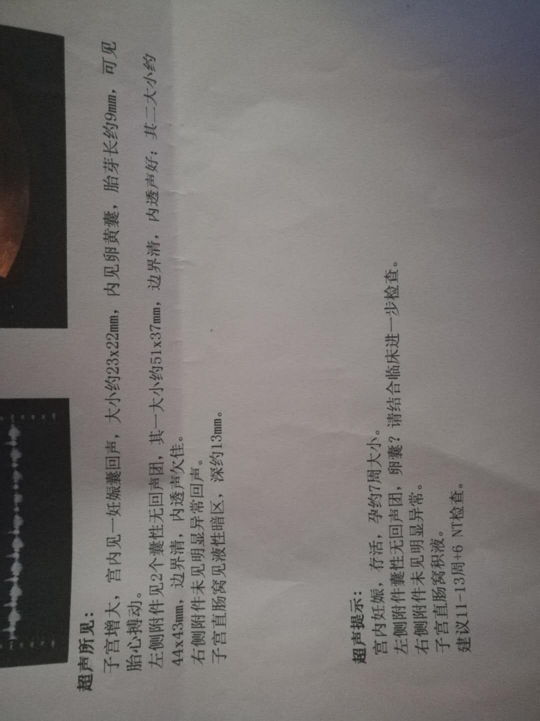 孕妈们，能帮我看看这是什么问题。