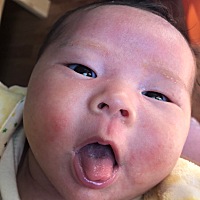 之前红屁股 涂这个很好用，现在脸上这样可以涂吗，你们有人脸上这样吗，我们的怎么问题这么多，带的真累...