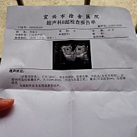 亲们帮我看男女  没有什么问题吧？