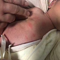 宝宝身上长了很多红点，有点像水泡，有知道是什么的吗