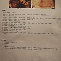 今天23周5天，做了糖耐通过，四维也过了，就是缺铁要补，四维应该没有大问题吧