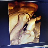 今天四维，有能看出这是佩琪还是乔治的吗