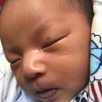 宝宝眼皮上有一个颗红红的 这是什么啊 有没有宝妈知道的