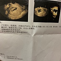 亲们帮我看看是佩琪还是乔治 😁