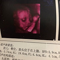 长的像爸爸还是妈妈