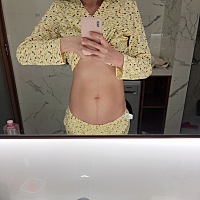 希望快点回到产前状态！怀孕期间增重24斤，无妊辰纹，产后第五天减掉16斤！带孩子真累……