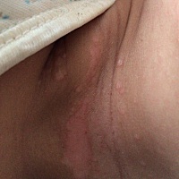 有人知道宝宝脖子这是怎么了吗