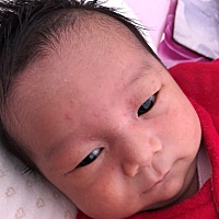 宝宝20天脸上出现这种红色小疹子，别的宝妈们知不知道这是怎么了，是热了么，心疼