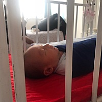 小宝贝二月十二刨腹产六斤六两，做完才发现刀口是竖的