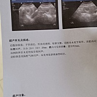 第一次检查，末次月经12月14号。没有看到胎芽，还有戏吗？