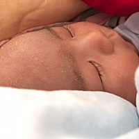 各位宝妈们，你们宝宝脸上光滑吗？我家宝宝脸上蜕皮还长了好多红点点，湿疹。脸上粗皮糙卡的，摸着心疼。