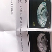 有谁看的懂吗？