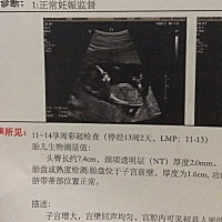 各位宝妈们，医生说宝宝动的很凶会不会有什么影响啊？做个nt半天不配合，不停的翻身，是不是因为我吃什...