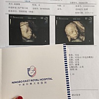 可以看出来是男孩还是女孩