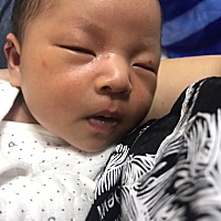 宝宝脸上起了好多小红点点 有没有宝妈知道是什么呀