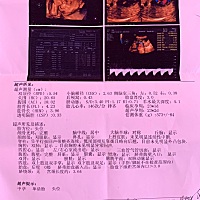 麻烦帮我看看是男宝宝还是女宝宝哦。嘿嘿