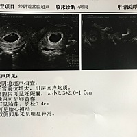 有懂的亲吗？帮忙看一下是男女？ B超孕囊数值看男女