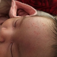 宝宝头上这是湿疹吗？有什么有效的药可以治疗的？