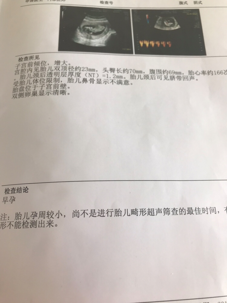 13周NT宝宝不配合 溜达一个小时还是不行，为娘很愁，还好都正常