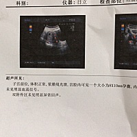 圆形胎囊 是女宝宝嘛？