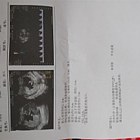 亲们，有谁能看来男女吗？