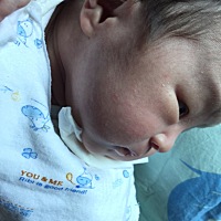 宝贝脸上长的小痘痘是怎么回事 怎么处理