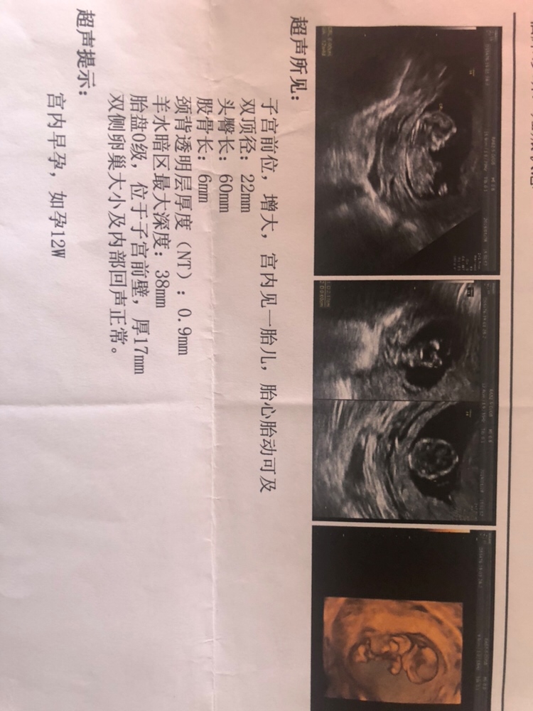 猜猜是男还是女