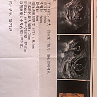 猜猜是男还是女